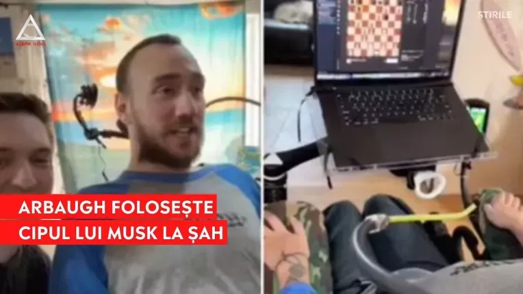 Primul om cu cip Neuralink in creier joaca sah cu ajutorul device-ului